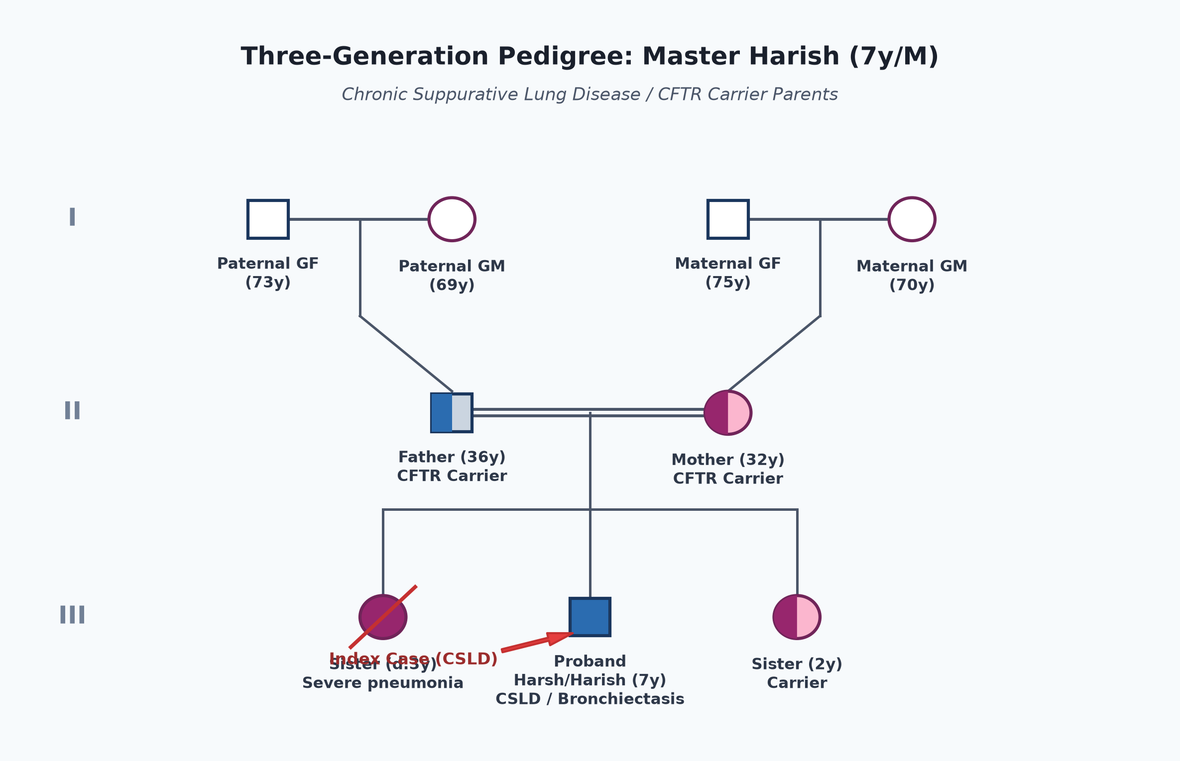 pedigree_bronchiectasis_harish.png