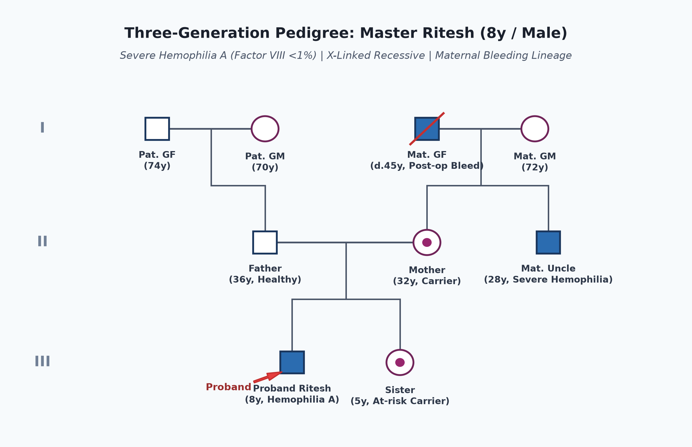 pedigree_hemophilia_ritesh.png